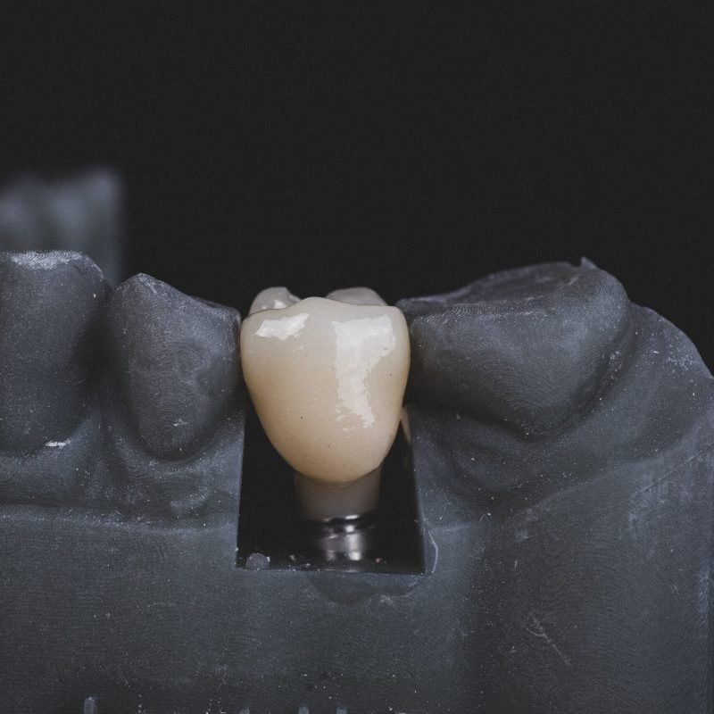 bogdan-condr-q1KLbswF70Y-unsplash